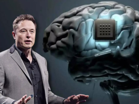 Cómo funciona el chip cerebral de Elon Musk que controla dispositivos con el pensamiento