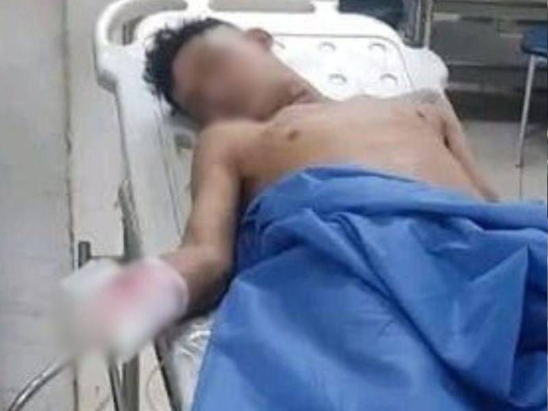 Delincuente lanza explosivo en Guayaquil… ¡y termina herido por su propia bomba!